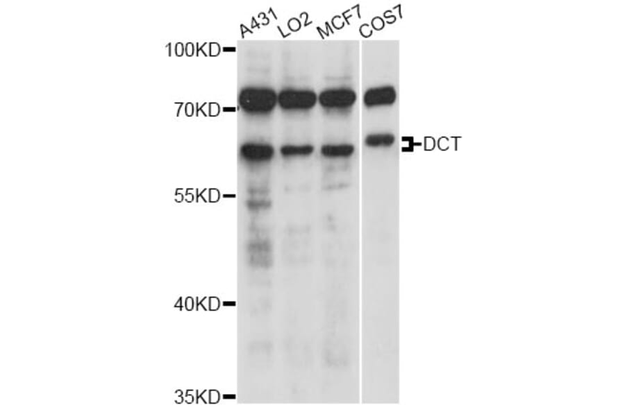 Western Blot - Anti-DCT Antibody (A6287) - Antibodies.com