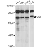 Western Blot - Anti-DCT Antibody (A6287) - Antibodies.com