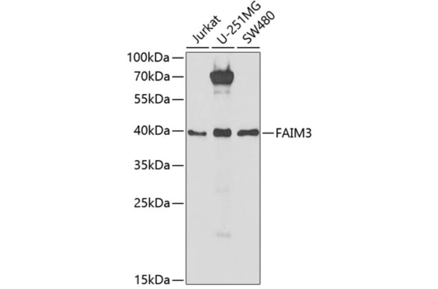 Western Blot - Anti-TOSO Antibody (A9831) - Antibodies.com