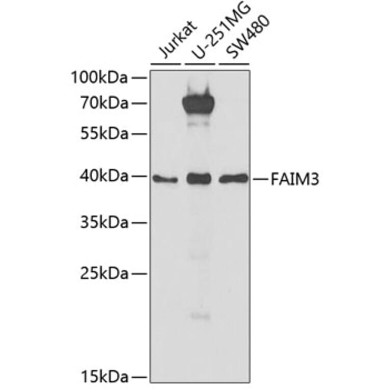 Western Blot - Anti-TOSO Antibody (A9831) - Antibodies.com