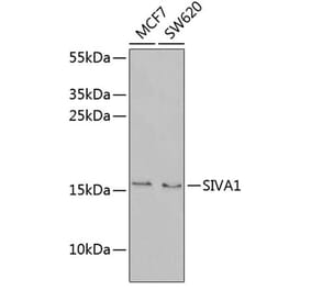 Western Blot - Anti-SIVA Antibody (A9834) - Antibodies.com