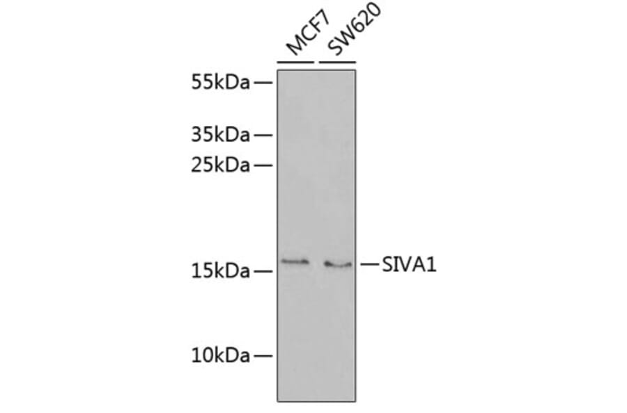 Western Blot - Anti-SIVA Antibody (A9834) - Antibodies.com