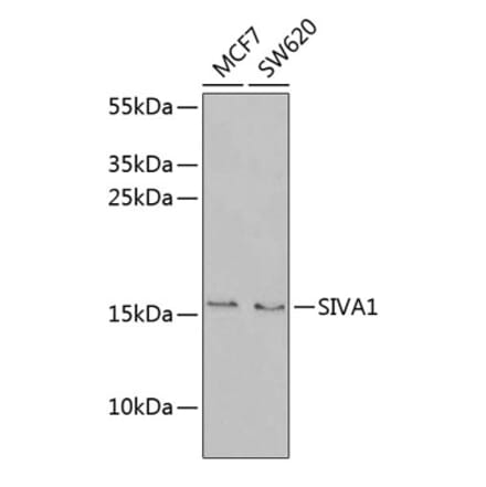 Western Blot - Anti-SIVA Antibody (A9834) - Antibodies.com