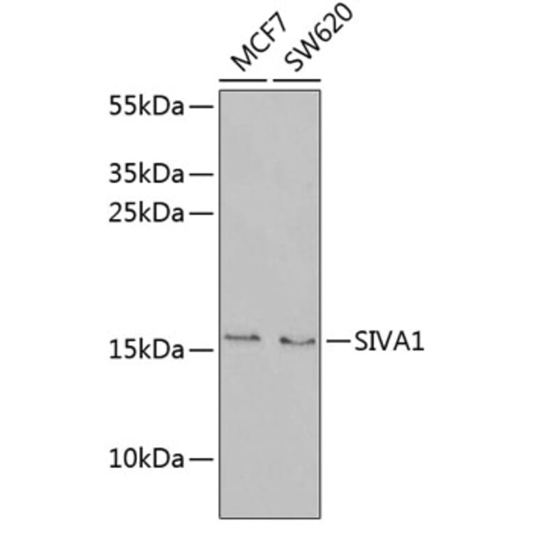 Western Blot - Anti-SIVA Antibody (A9834) - Antibodies.com
