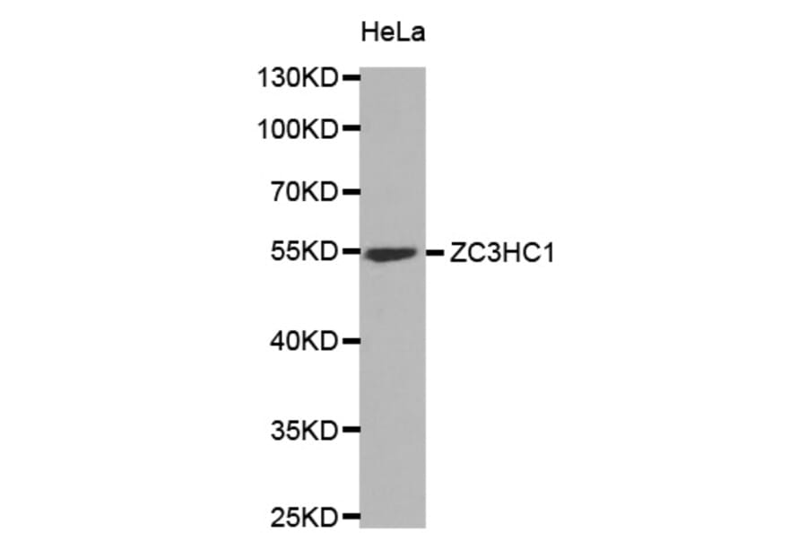 Western Blot - Anti-ZC3HC1 Antibody (A6331) - Antibodies.com