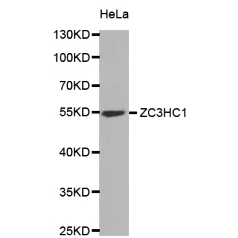 Western Blot - Anti-ZC3HC1 Antibody (A6331) - Antibodies.com