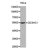 Western Blot - Anti-ZC3HC1 Antibody (A6331) - Antibodies.com