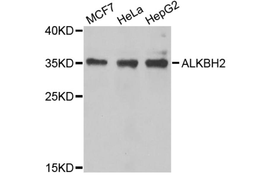 Western Blot - Anti-ALKBH2 Antibody (A6340) - Antibodies.com