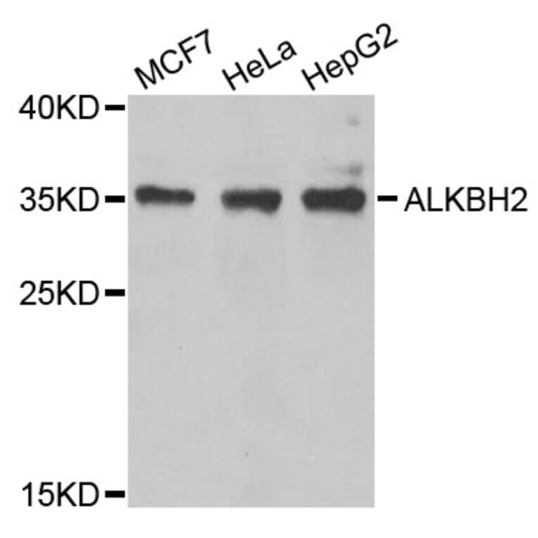 Western Blot - Anti-ALKBH2 Antibody (A6340) - Antibodies.com