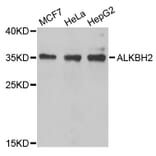 Western Blot - Anti-ALKBH2 Antibody (A6340) - Antibodies.com