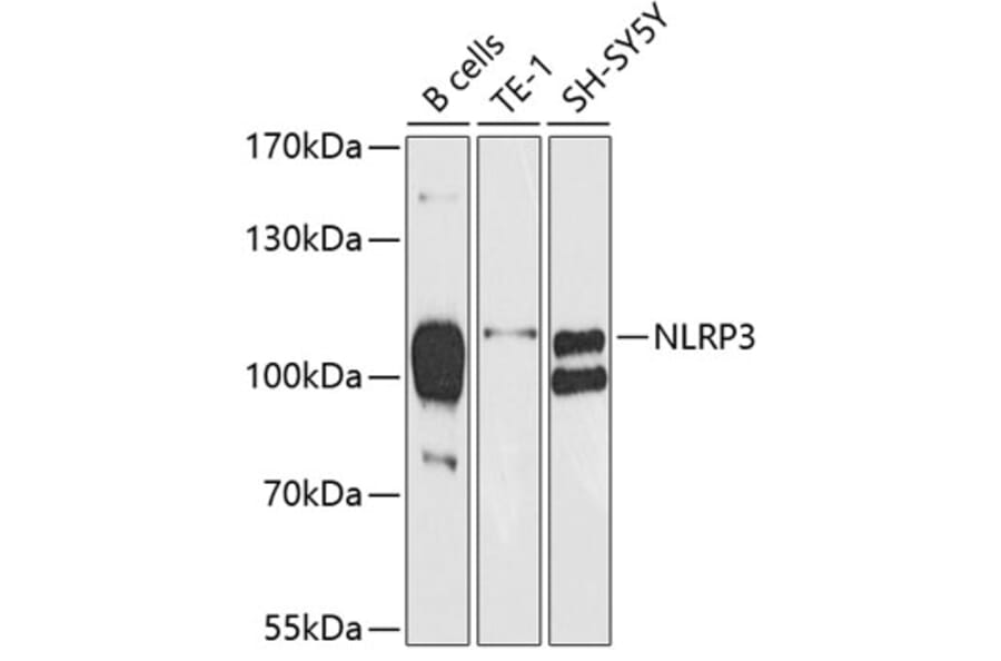 Western Blot - Anti-NLRP3 Antibody (A6345) - Antibodies.com