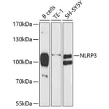 Western Blot - Anti-NLRP3 Antibody (A6345) - Antibodies.com