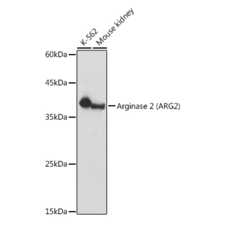 Western Blot - Anti-Arg2 Antibody (A9841) - Antibodies.com