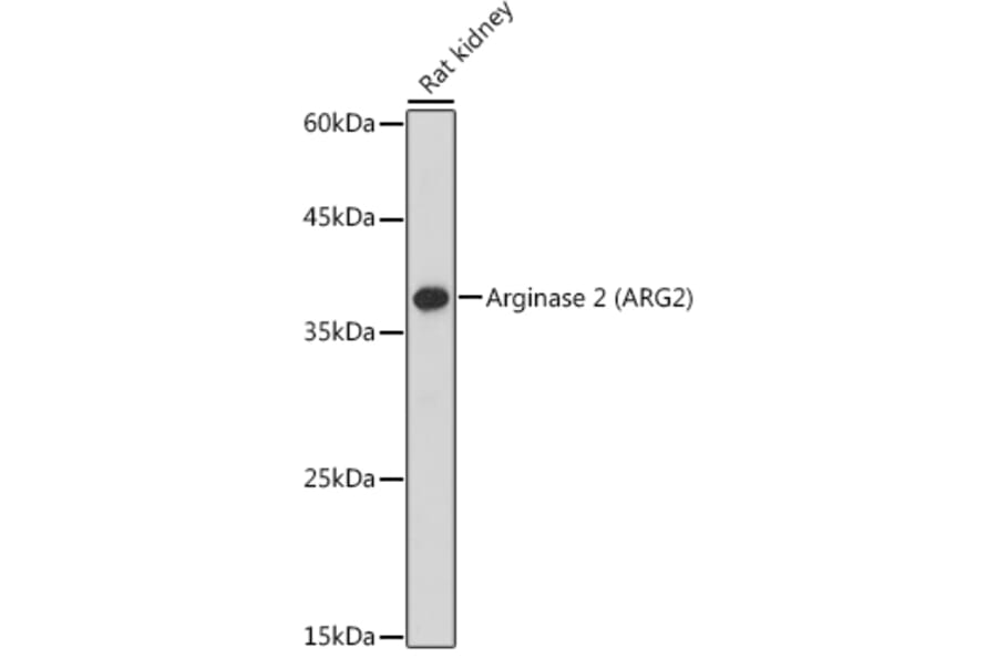 Western Blot - Anti-Arg2 Antibody (A9841) - Antibodies.com