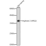 Western Blot - Anti-Arg2 Antibody (A9841) - Antibodies.com