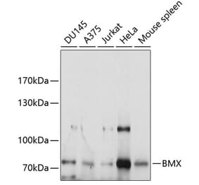 Western Blot - Anti-BMX Antibody (A9842) - Antibodies.com