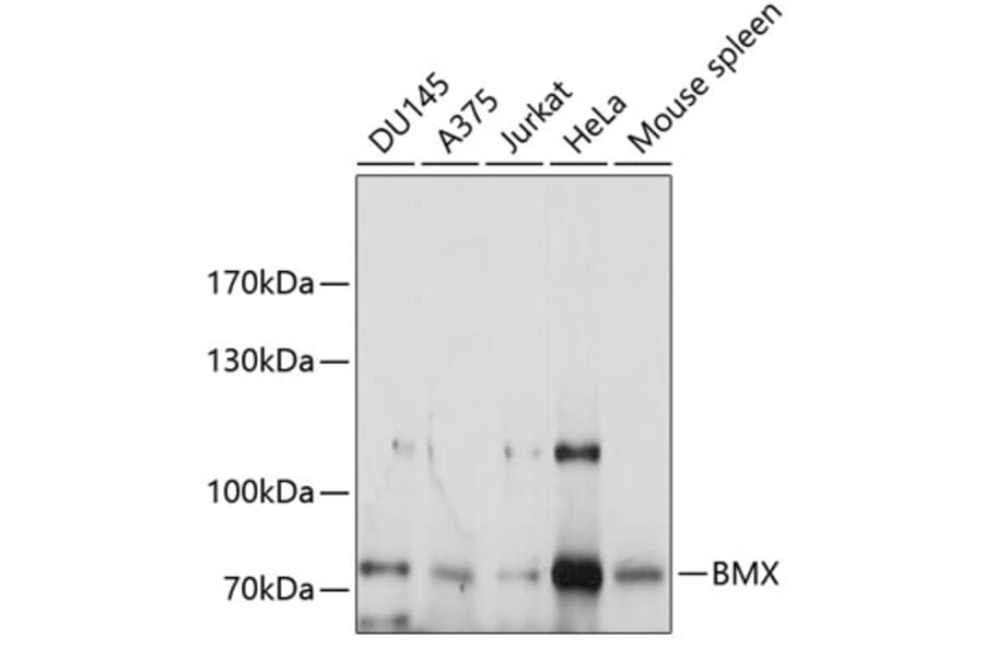 Western Blot - Anti-BMX Antibody (A9842) - Antibodies.com