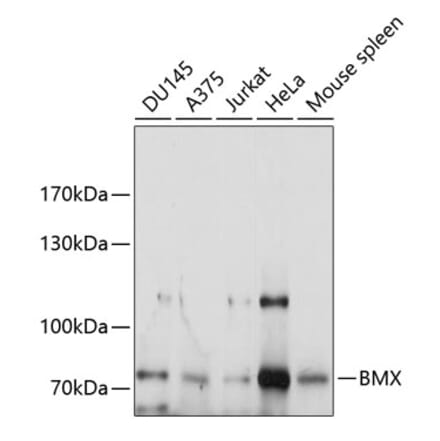Western Blot - Anti-BMX Antibody (A9842) - Antibodies.com