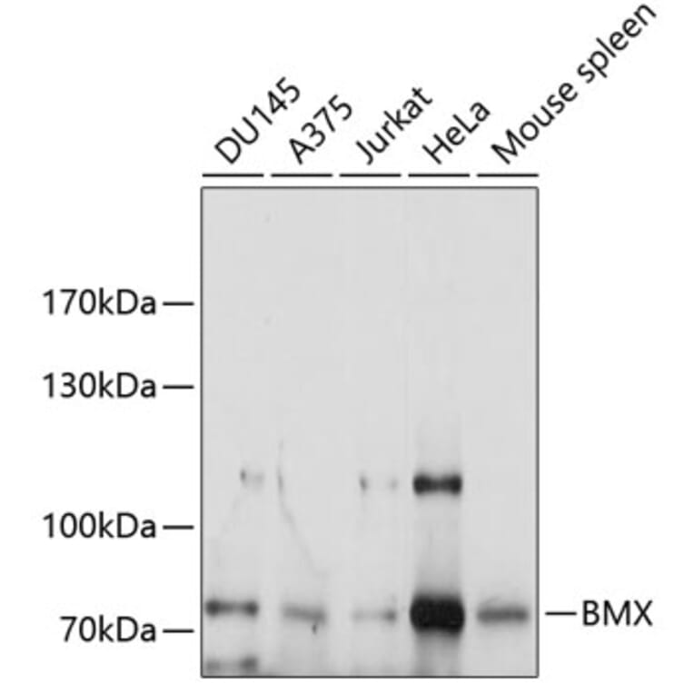 Western Blot - Anti-BMX Antibody (A9842) - Antibodies.com