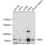 Western Blot - Anti-BMX Antibody (A9842) - Antibodies.com