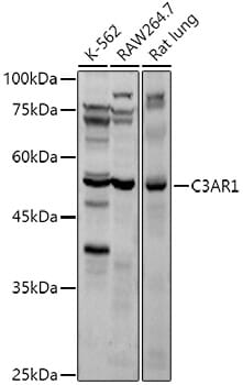 Western blot analysis of extracts of various cell lines, using Anti-C3AR1 Antibody (A6361) at 1:3000 dilution.
Secondary antibody: Goat Anti-Rabbit IgG (H+L) (HRP) (AS014) at 1:10,000 dilution.
Lysates / proteins: 25µg per lane.
Blocking buffer: 3% non-fat dry milk in TBST.
Detection: ECL Basic Kit (RM00020).
Exposure time: 15s.