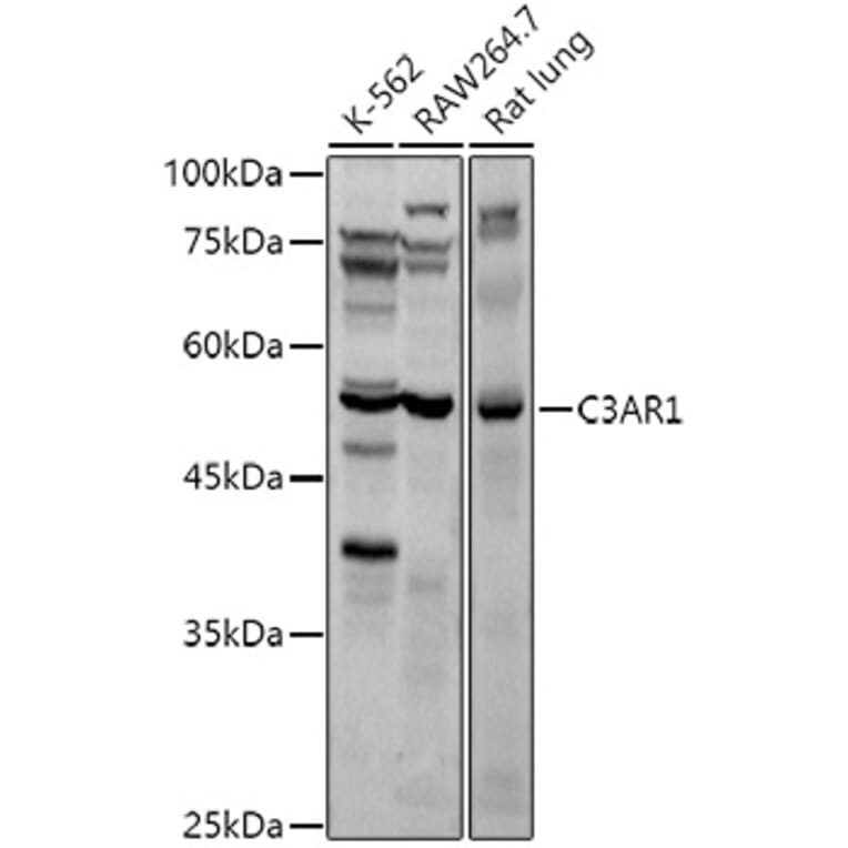 Western Blot - Anti-C3a R Antibody (A9843) - Antibodies.com
