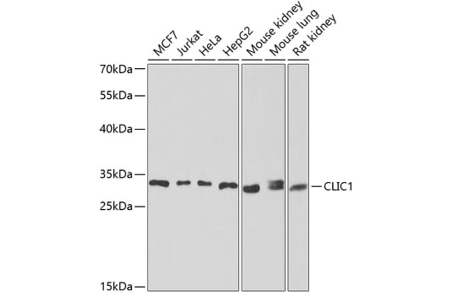 Western Blot - Anti-CLIC1 Antibody (A9844) - Antibodies.com