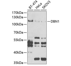 Western Blot - Anti-Drebrin Antibody (A9845) - Antibodies.com