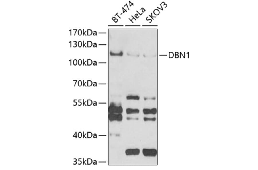 Western Blot - Anti-Drebrin Antibody (A9845) - Antibodies.com