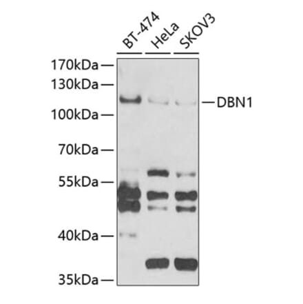 Western Blot - Anti-Drebrin Antibody (A9845) - Antibodies.com