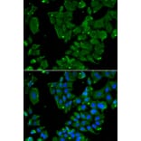 Immunofluorescence - Anti-Drebrin Antibody (A9845) - Antibodies.com