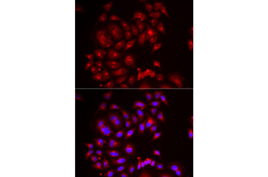 Immunofluorescence - Anti-SLC26A2 Antibody (A6369) - Antibodies.com