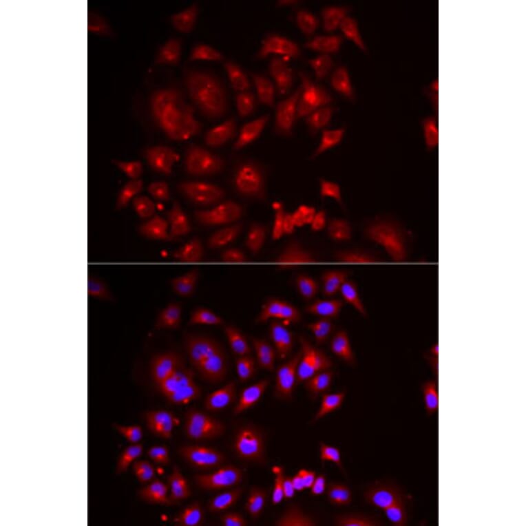 Immunofluorescence - Anti-SLC26A2 Antibody (A6369) - Antibodies.com