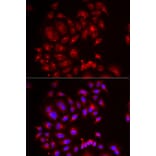 Immunofluorescence - Anti-SLC26A2 Antibody (A6369) - Antibodies.com