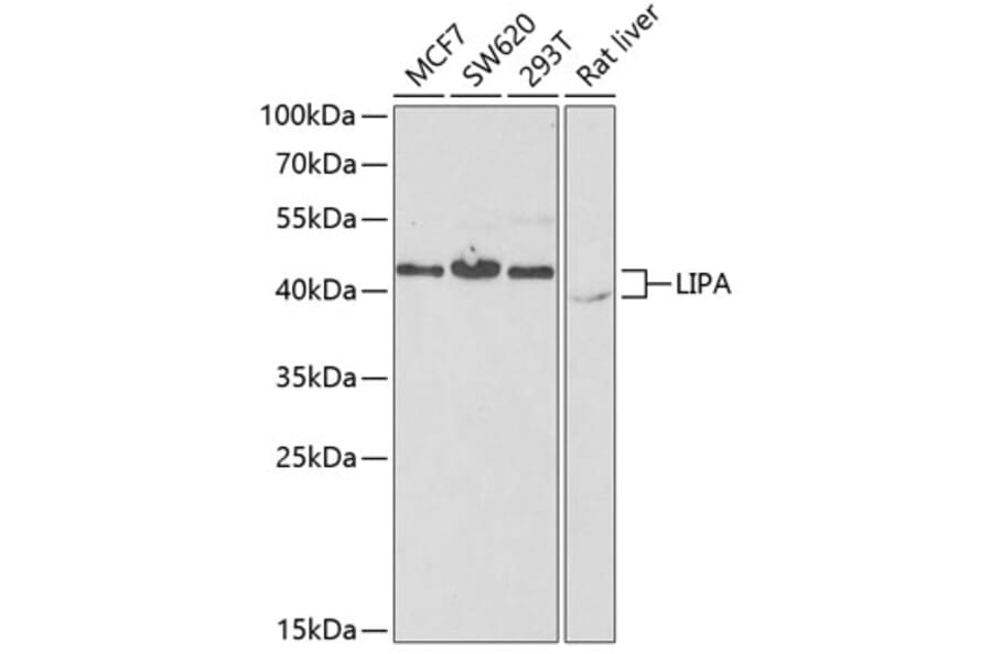 Western Blot - Anti-Lysosomal acid lipase/LAL Antibody (A9847) - Antibodies.com