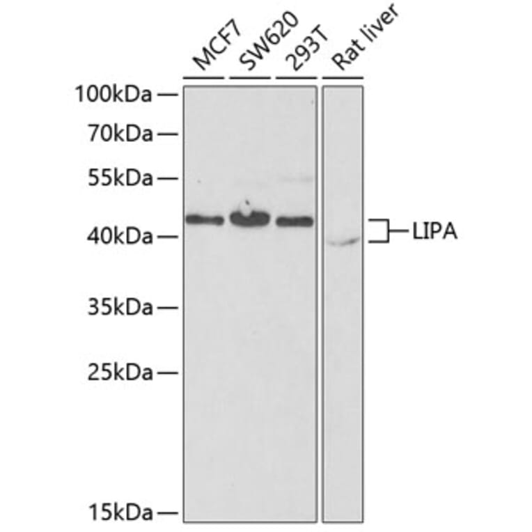 Western Blot - Anti-Lysosomal acid lipase/LAL Antibody (A9847) - Antibodies.com