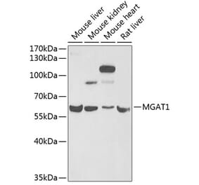 Western Blot - Anti-MGAT1 Antibody (A9848) - Antibodies.com