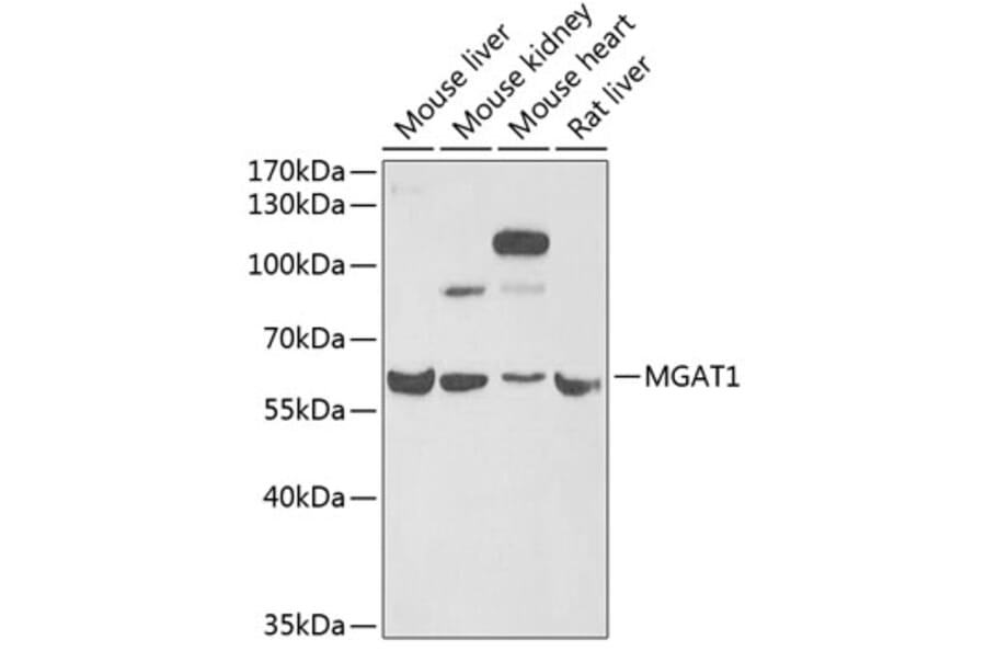 Western Blot - Anti-MGAT1 Antibody (A9848) - Antibodies.com
