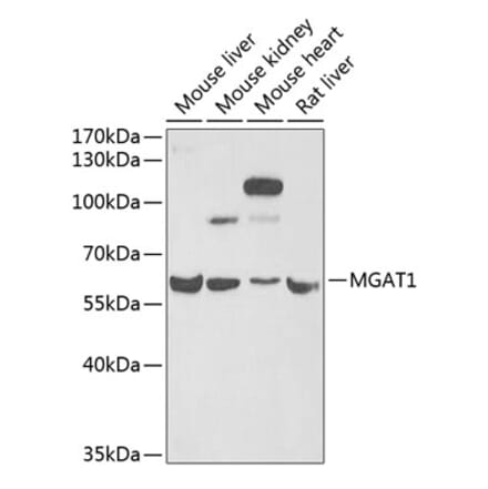 Western Blot - Anti-MGAT1 Antibody (A9848) - Antibodies.com