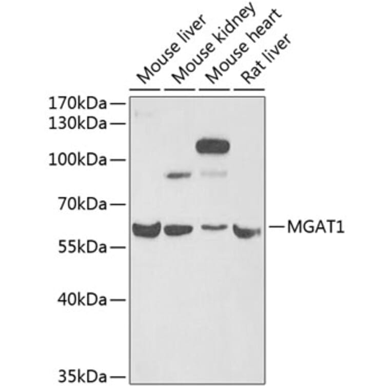 Western Blot - Anti-MGAT1 Antibody (A9848) - Antibodies.com