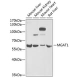 Western Blot - Anti-MGAT1 Antibody (A9848) - Antibodies.com