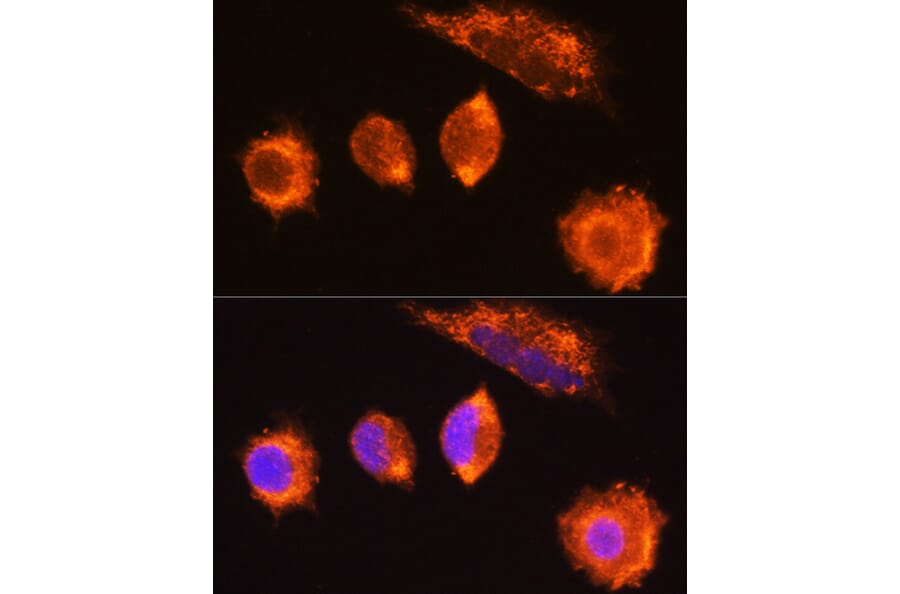 Immunofluorescence - Anti-MGAT1 Antibody (A9848) - Antibodies.com