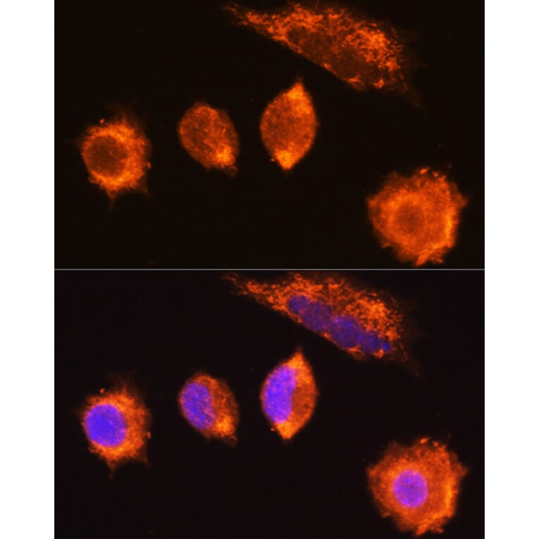 Immunofluorescence - Anti-MGAT1 Antibody (A9848) - Antibodies.com