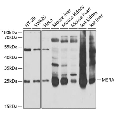 Western Blot - Anti-MSRA Antibody (A9849) - Antibodies.com
