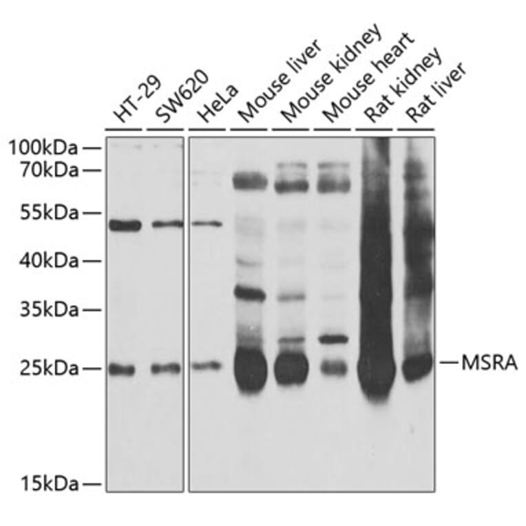 Western Blot - Anti-MSRA Antibody (A9849) - Antibodies.com