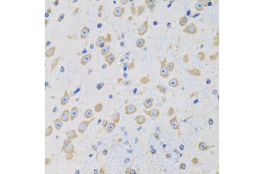 Immunohistochemistry - Anti-MSRA Antibody (A9849) - Antibodies.com