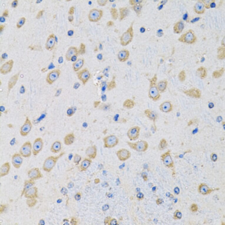 Immunohistochemistry - Anti-MSRA Antibody (A9849) - Antibodies.com