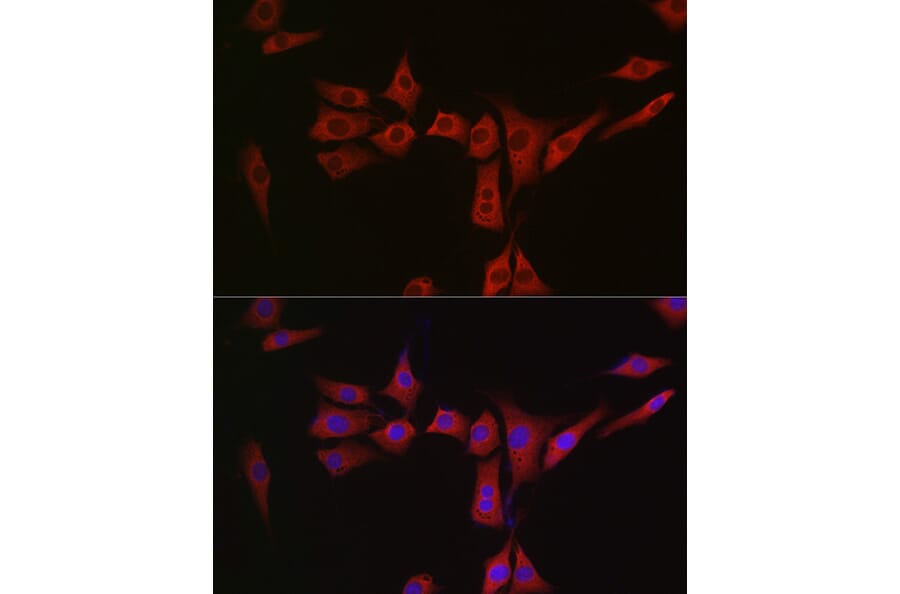Immunofluorescence - Anti-MSRA Antibody (A9849) - Antibodies.com