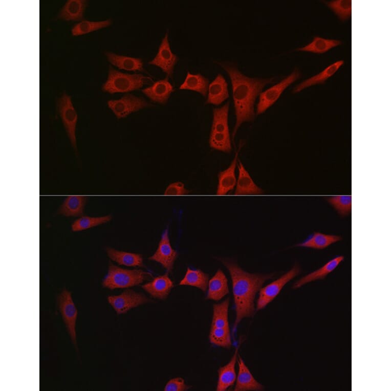 Immunofluorescence - Anti-MSRA Antibody (A9849) - Antibodies.com