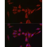 Immunofluorescence - Anti-MSRA Antibody (A9849) - Antibodies.com